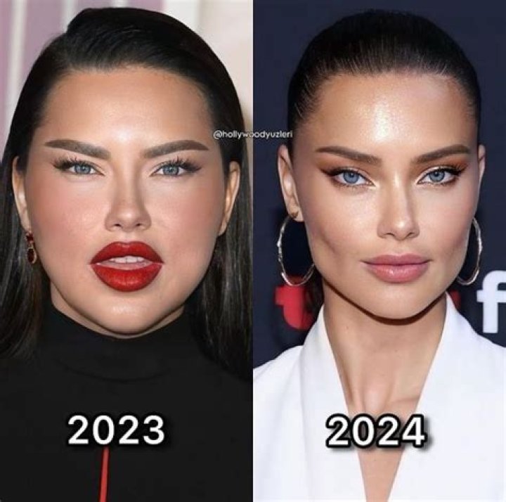 Adriana Lima and Ozempic: Understanding the Relationship Between the Supermodel and the Weight Loss Drug