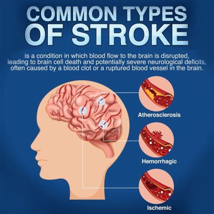 Carol Burnett’s Journey Through a Stroke: A Tale of Resilience