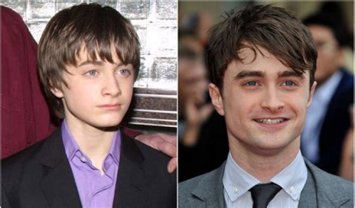 Daniel Radcliffe's Age in 2001: Shocking Revelation