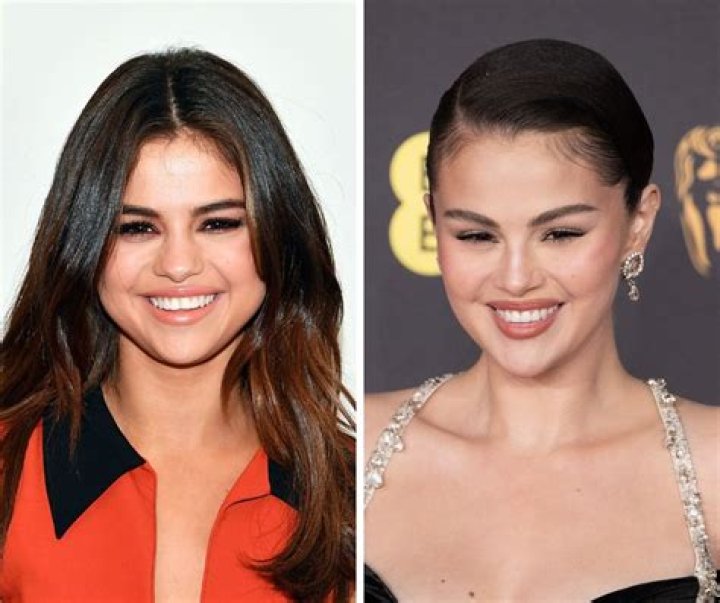 Did Selena Gomez Get Breast Implants? A Comprehensive Analysis