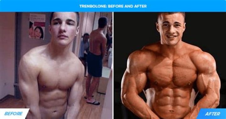 Do The Tren Twins Take Steroids? Unveiling the Truth Behind Their Muscular Physiques