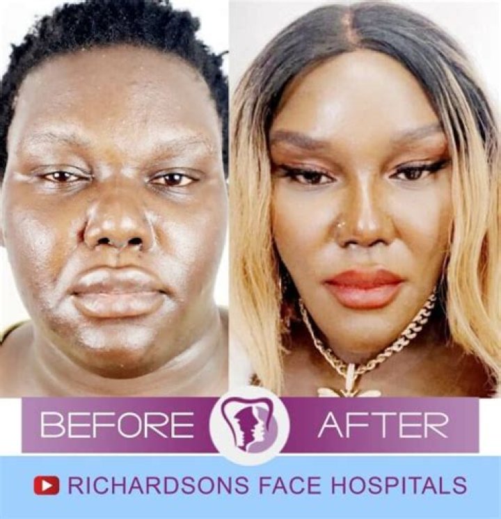 Exploring Don Johnson's Journey with Plastic Surgery
