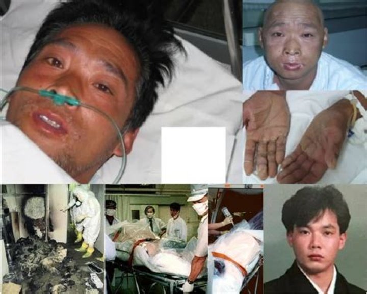 Hisashi Ouchi Real Photos 1999: The Tragic Story of the Hiroshima Nuclear Accident Victim