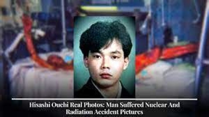 Hisashi Ouchi Real Photos: Unveiling the Truth Behind the Infamous Incident