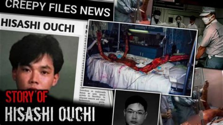Hisashi Ouchi Real Photos: Unveiling the Truth Behind the Tragic Incident
