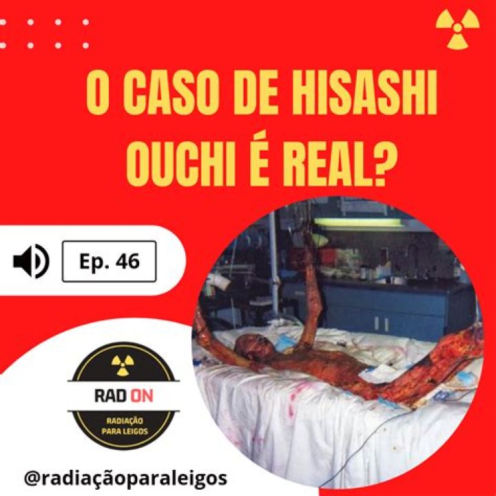 Hisashi Photos Real: Unveiling the Authenticity Behind the Images