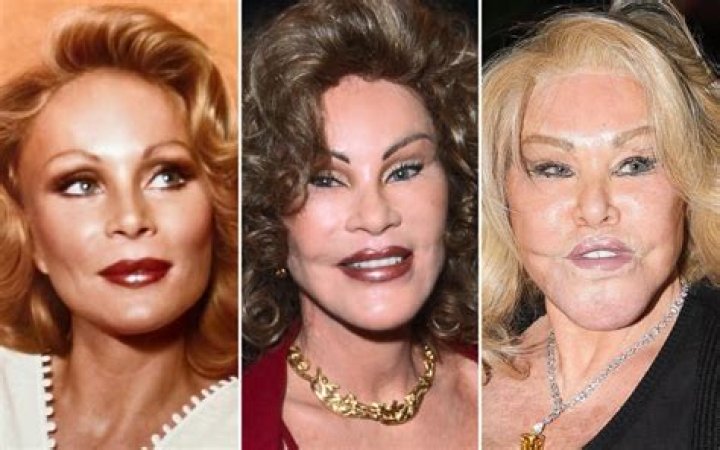 Jocelyn Wildenstein: A Look at Her Life Before Any Surgery