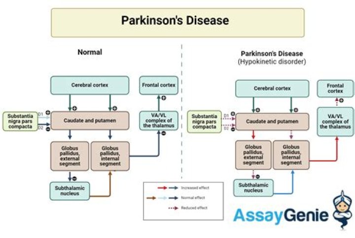 Kenny Johnson: Battling Parkinson's Disease with Resilience