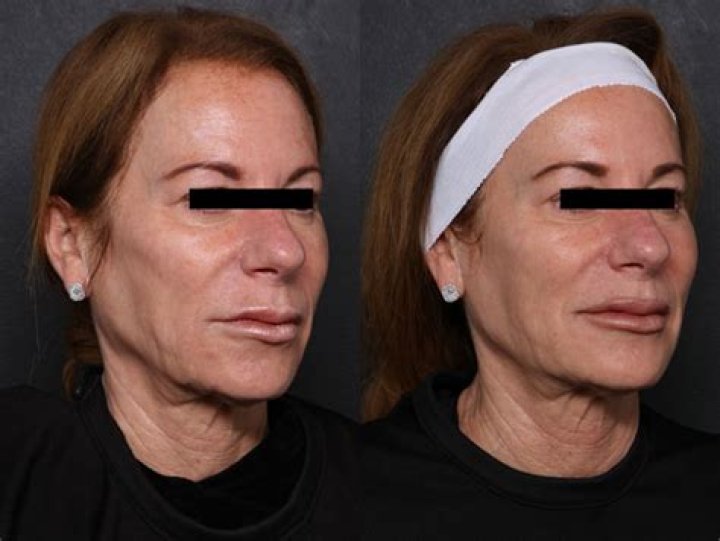 Krauss Dermatology: Your Trusted Partner for Skin Health