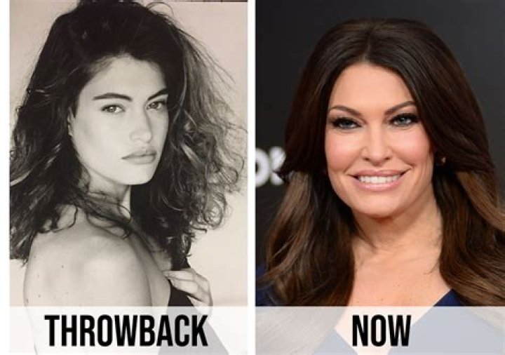 Revealing the Transformation: A Look at Kimberly Guilfoyle's Plastic Surgery Photos