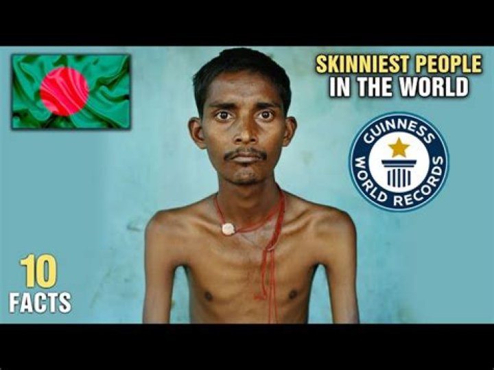 The World's Skinniest Person: Exploring the Story, Causes, and Health Implications