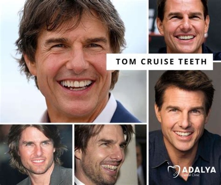 Tom Cruise Teeth: The Story Behind His Iconic Smile