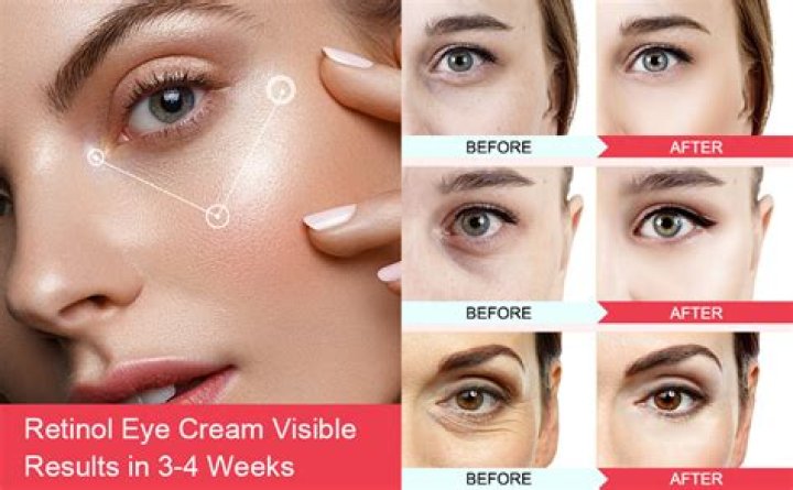 Top Under Eye Creams: Your Guide to Youthful Eyes