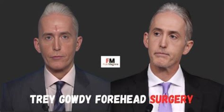 Trey Gowdy's Nose: What Happened?