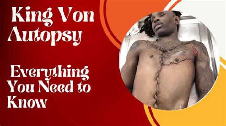 Uncovering the Truth: King Von Autopsy Results Explained