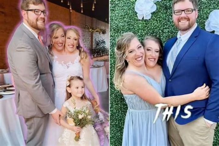 Understanding the Heartfelt Journey of Abby and Brittany Hensel: Sad News and Reflections
