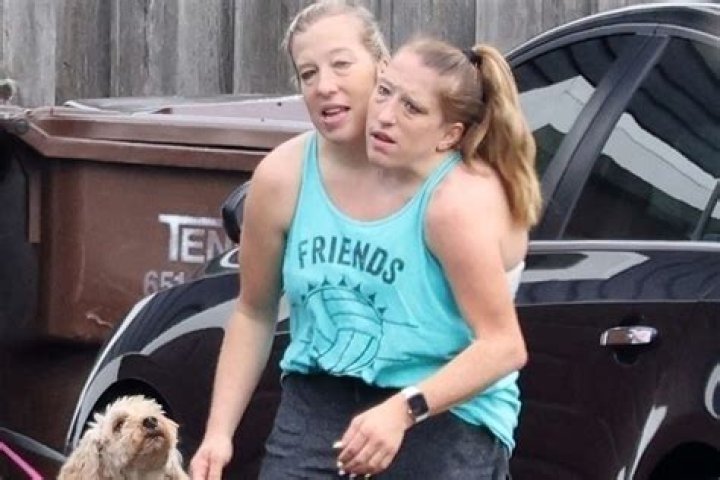 Unraveling the Abby and Brittany Hensel Sad News 2024 Update