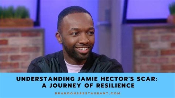 Unveiling the Intriguing Story Behind Jamie Hector's Scar