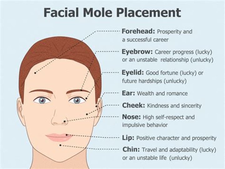 Unveiling the Secrets: The Significance of Moles on the Face