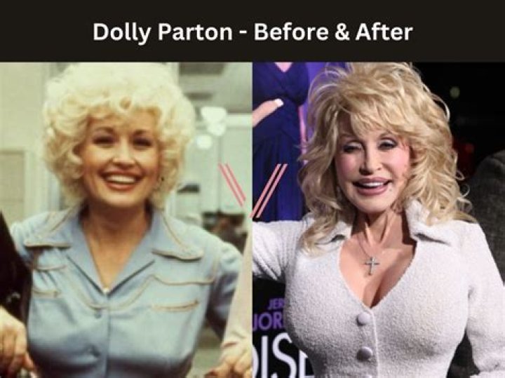 When Did Dolly Parton Die: The Life and Legacy of an American Icon
