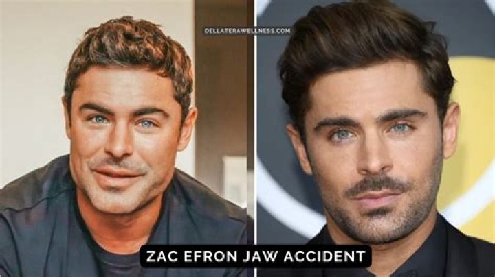 Zac Efron Face Accident: The Untold Story Behind the Star's Transformation